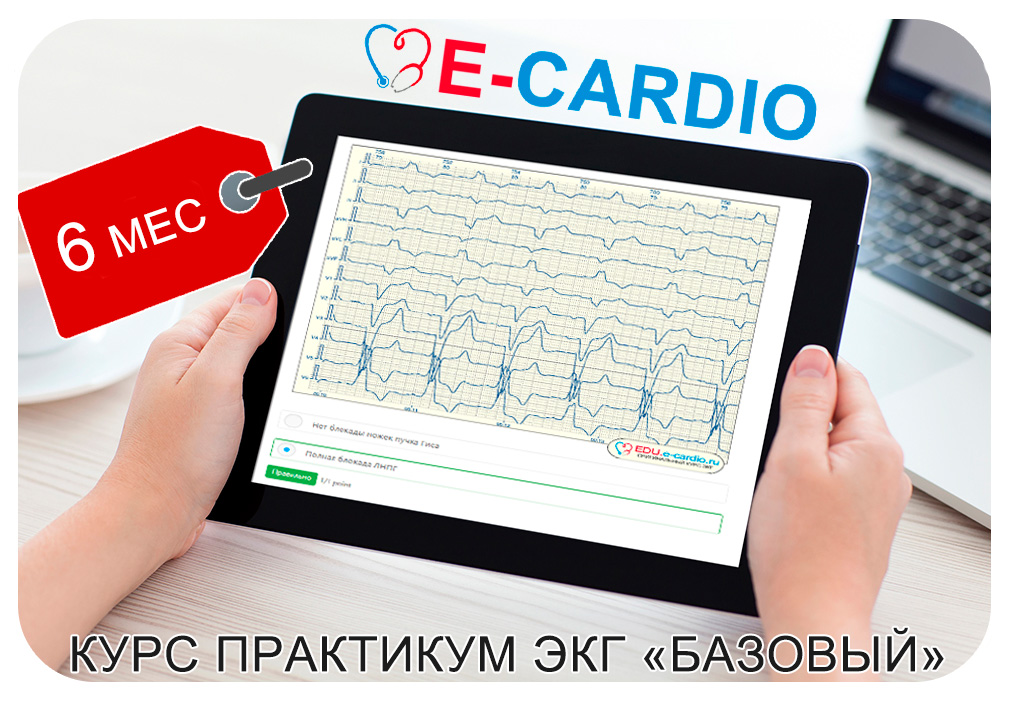 Курс ЭКГ "базовый"