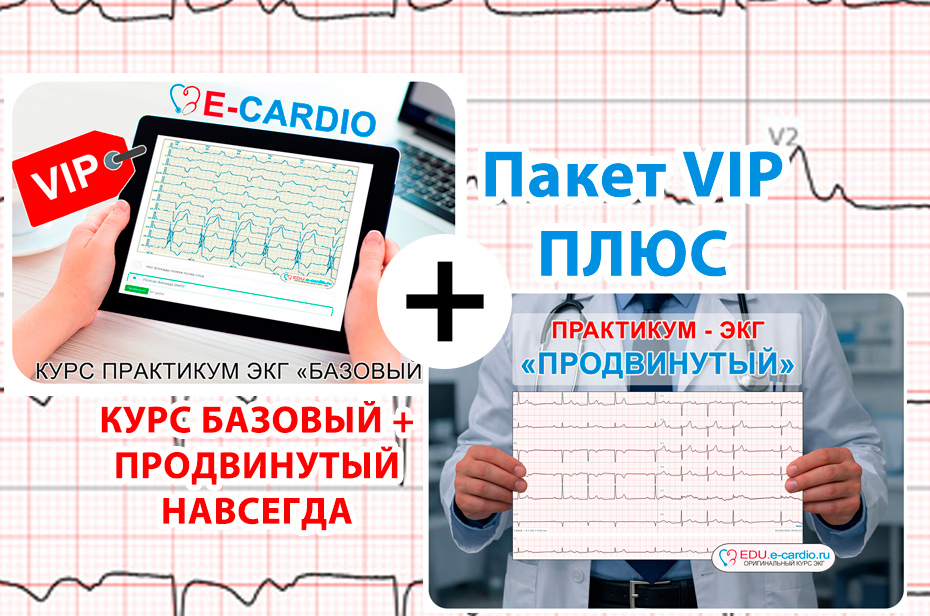 Курс ЭКГ "БАЗОВЫЙ+ПРОДВИНУТЫЙ" VIP-ПЛЮС (навсегда)